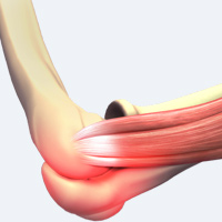 Elbow Sprains & Strains