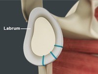 Shoulder Stabilization