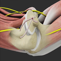 UCL Reconstruction 